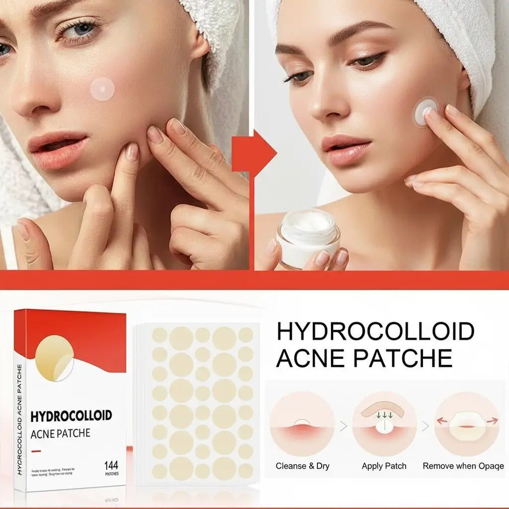 Patchs Anti-Acné Invisibles - Lot de 144 Pièces