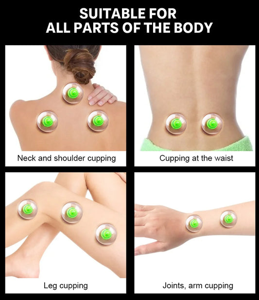 Kit de 6 Ventouses avec Pompe - Massage Anti-Cellulite et Détox
